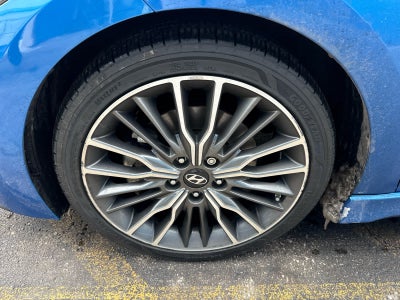 2018 Hyundai Elantra Sport